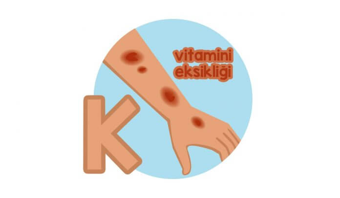 k-vitamini-eksikligi